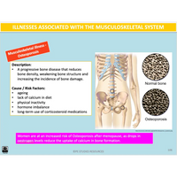 UNIT 1 AOS 1 - How does the Musculoskeletal System work to produce movement? (2nd ed) - Powerpoint